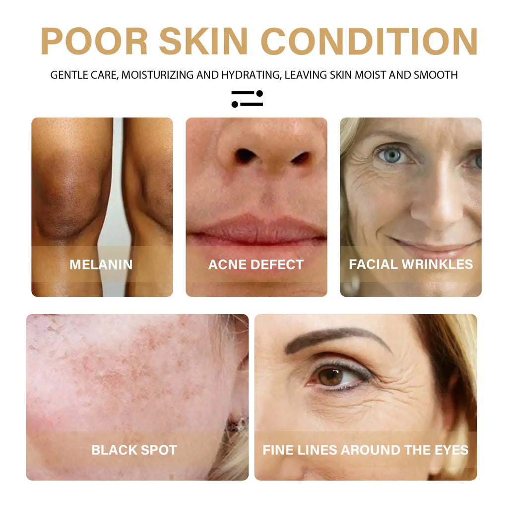 Turmeric Dark Spot Correction, Moisturizing, And Repairing Skin Tone Serum