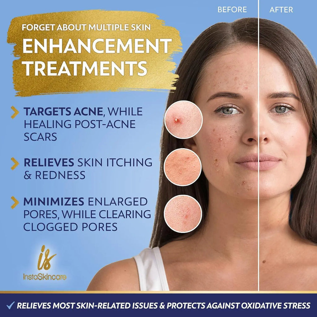 Niacinamide Serum 8Oz - 10% with Zinc, 1% Vitamin B3 Brightening Serum