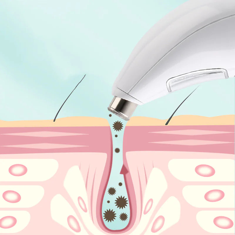 Blackhead Pore Cleansing Artifact Facial Massage